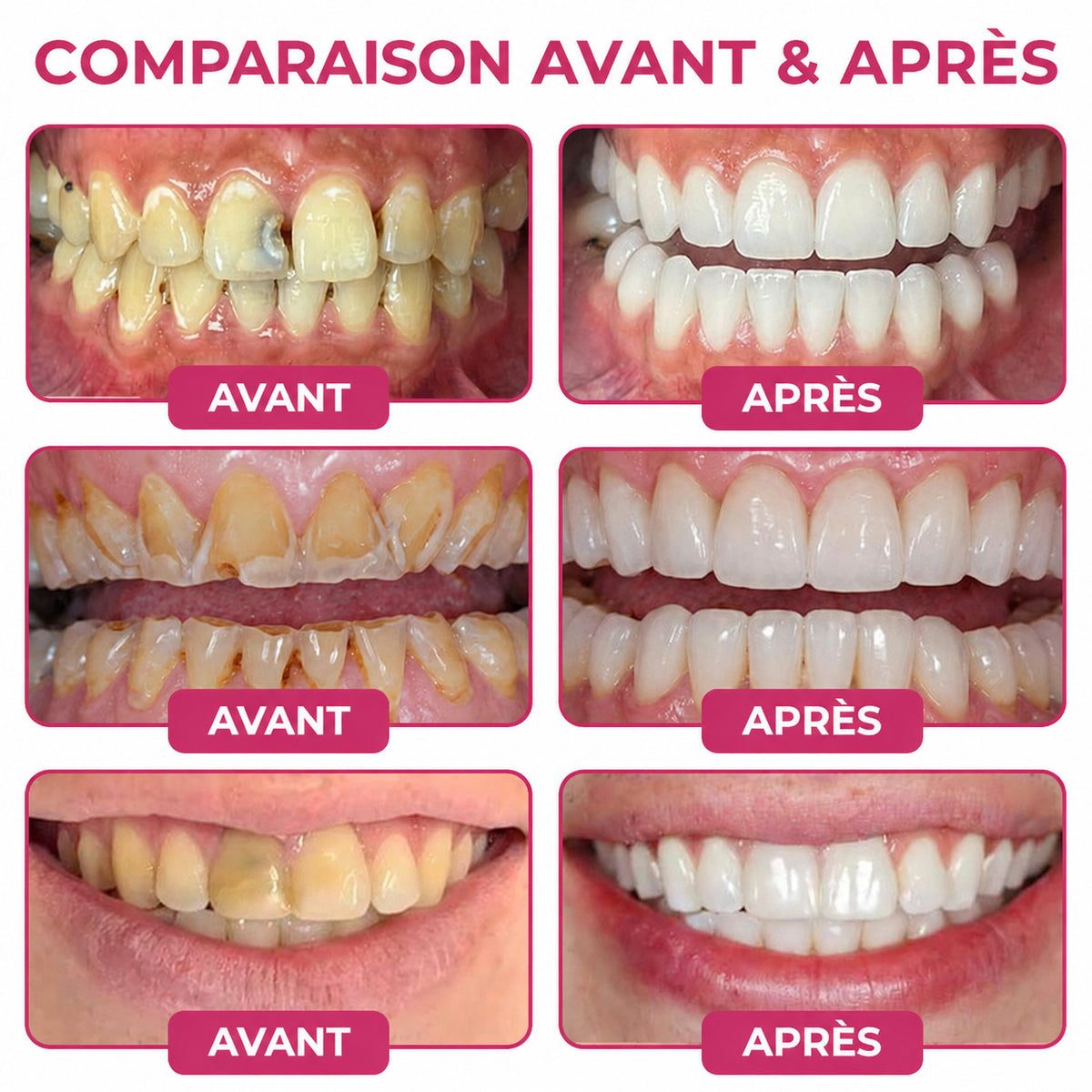 🇫🇷 Trilumia® DenPerm🦷 Gel de Soin Dentaire Avancé – Émail Plus Fort & Sourire Naturel ✨