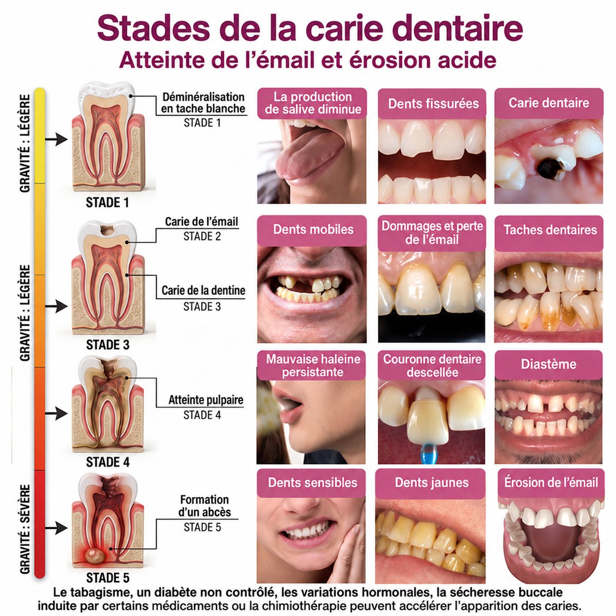 🇫🇷 Trilumia® DenPerm🦷 Gel de Soin Dentaire Avancé – Émail Plus Fort & Sourire Naturel ✨