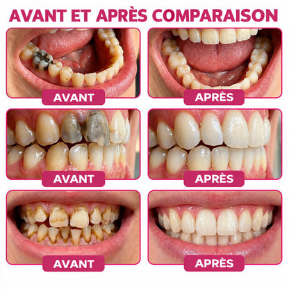 🇫🇷 Trilumia® DenPerm🦷 Gel de Soin Dentaire Avancé – Émail Plus Fort & Sourire Naturel ✨